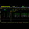 PCAN Diag FD Bundle - Diagnostic Tool with Quick Charging Station